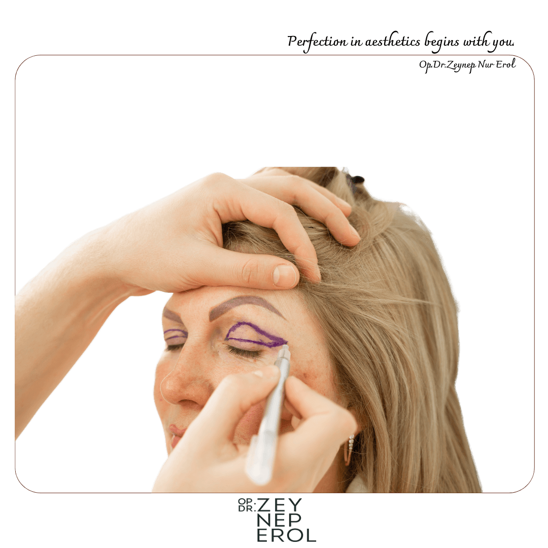 Chirurgie des paupières