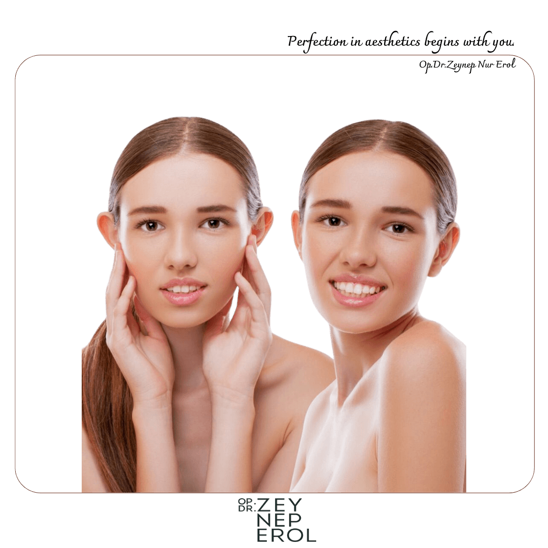 Chirurgie de l'oreille décollée